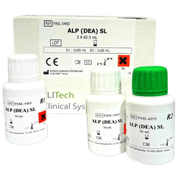 Fosfatasa Alcalina (ALP)