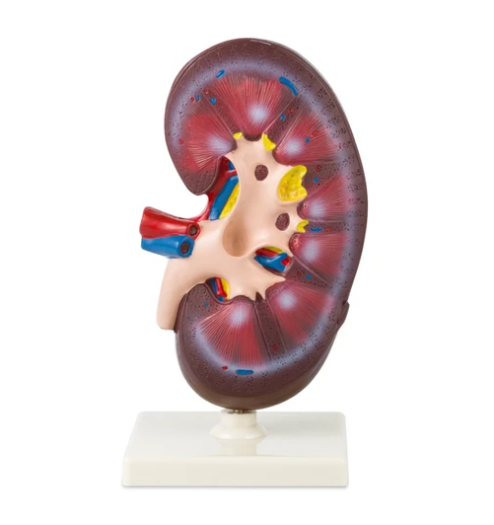 Modelo Riñón Grande. Modelo CVQ7049