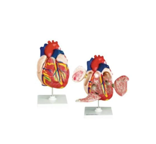 Modelo Corazón Mediano. Modelo CVQ7010